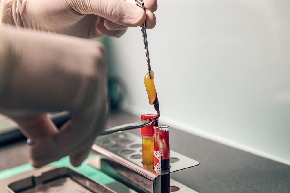 socket grafting | dental extractions east hills, NSW