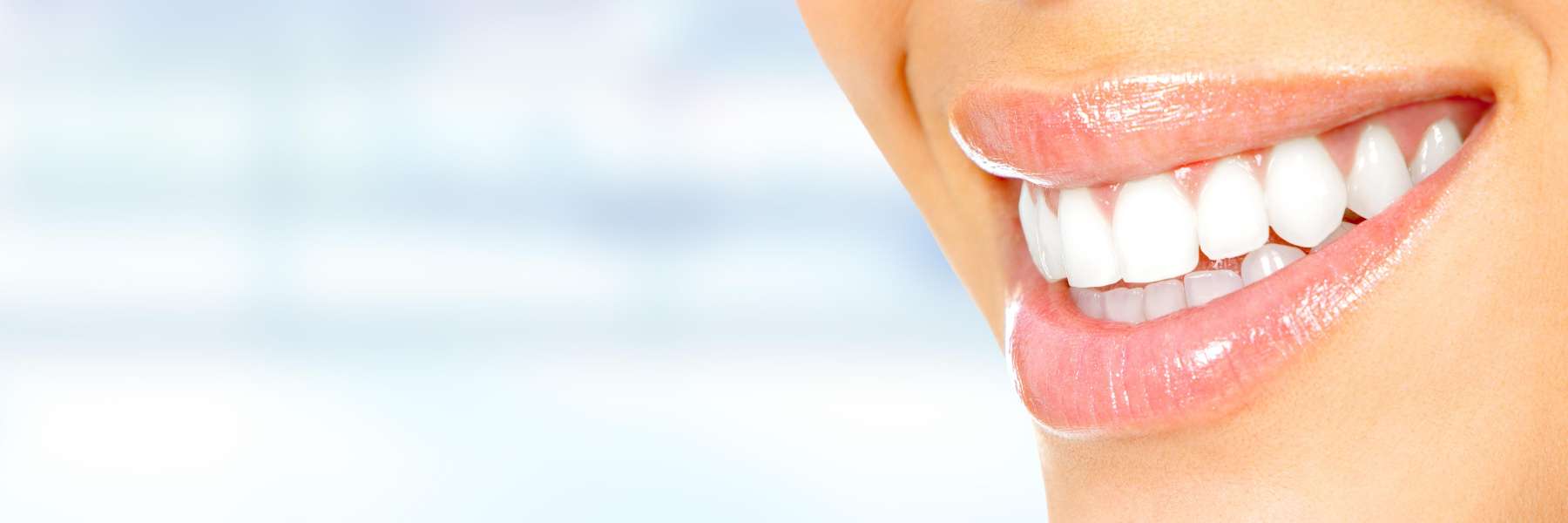 Patient after full smile makeover in Panania