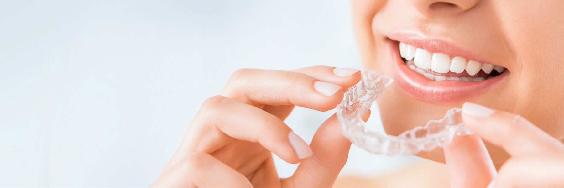 Woman inserting a clear Invisalign aligner tray, smiling with white teeth visible