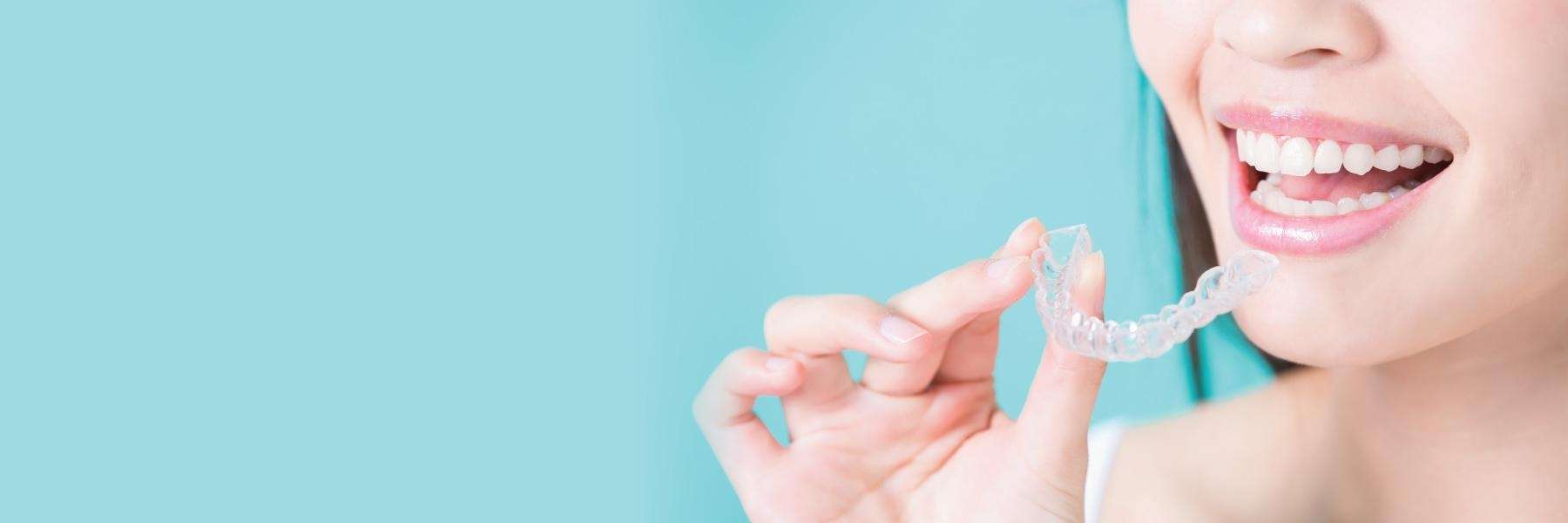Invisalign clear braces east hills, NSW