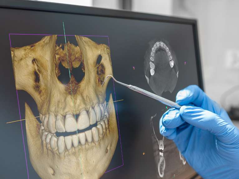 Dentist East Hills | Cone Beam Computed Tomography